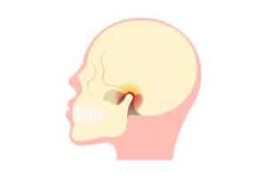 Κροταφογναθικό Σύνδρομο 22 Κροταφογναθική Άρθρωση